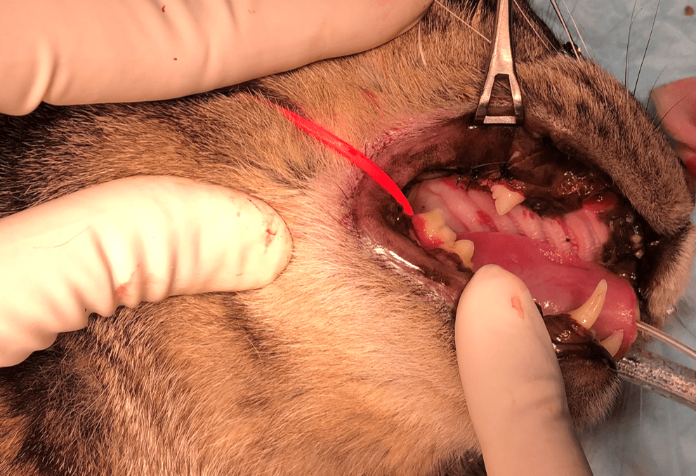 犬歯抜歯部分の縫合