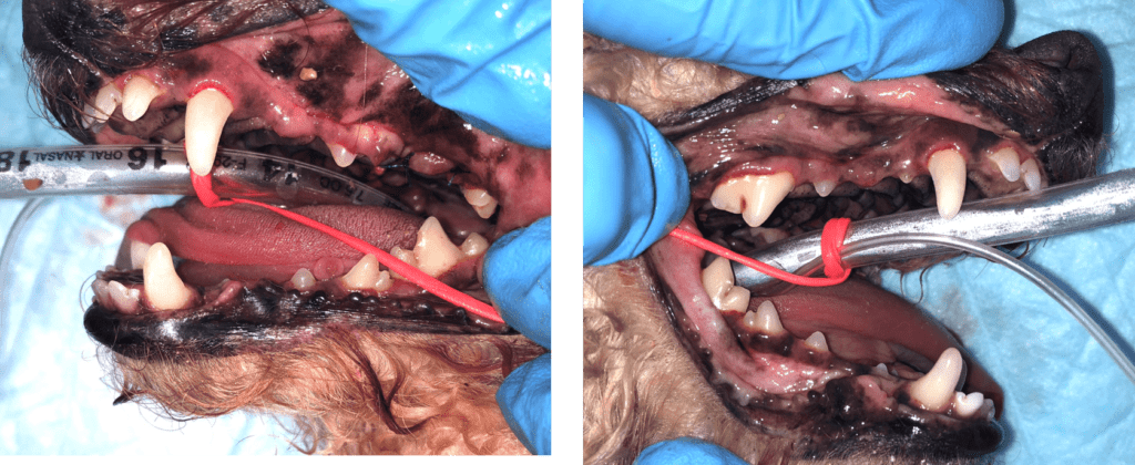 徹底検査による診断